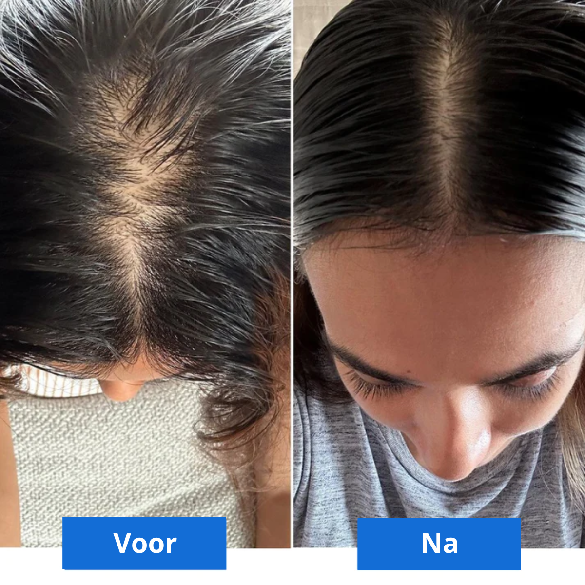 Scalp Bliss – Luxurious Head Massage for Relaxation