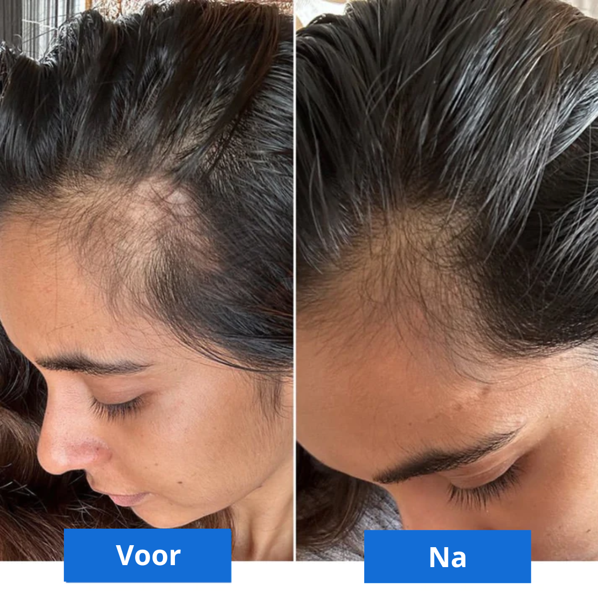 Scalp Bliss – Luxurious Head Massage for Relaxation