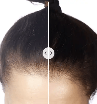 ChicBlend - 5-in-1 Multifunctional Hair Comb